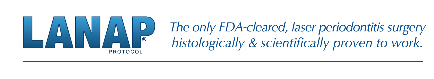 LANAP Protocol — laser-assisted periodontal treatment